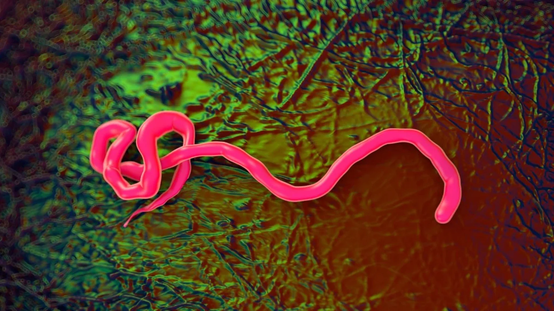 An illustration of the ebola virus. (RoyaltyStockPhoto/Science Photo Library/Getty Images)