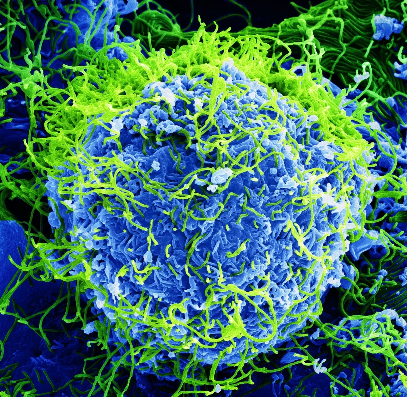A colorized scanning electron micrograph of Ebola virus particles (green) budding from an infected cell. (BernbaumJG/CC BY 4.0)