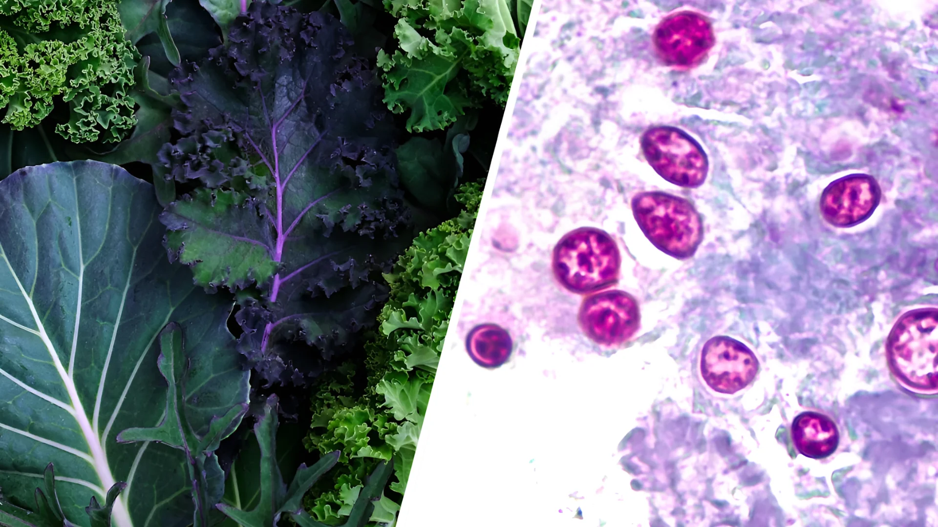 Experts say taking certain precautions before eating fresh produce can help reduce the risk of illness during the outbre