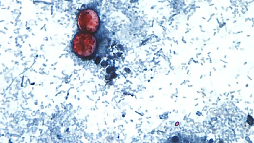 Cases of cyclosporiasis are known to rise during spring and summer months in the US, but case counts are particularly high this year. Melanie Moser/CDC/DPDx